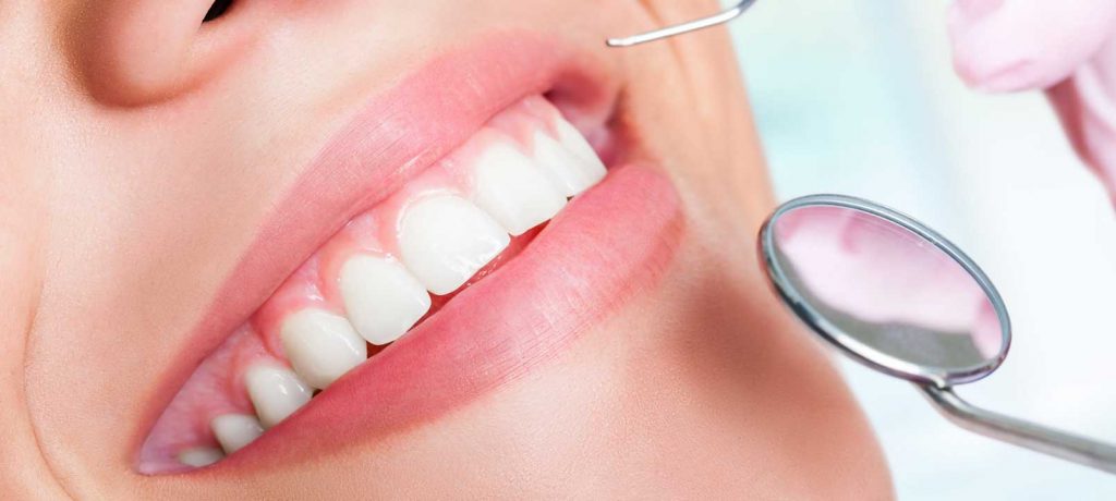 3 FAQs: How do I Get Affordable Straight Teeth?