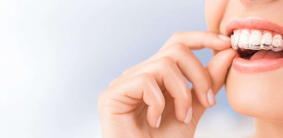 Orthodontic Care: How To Make Your Teeth Straighter