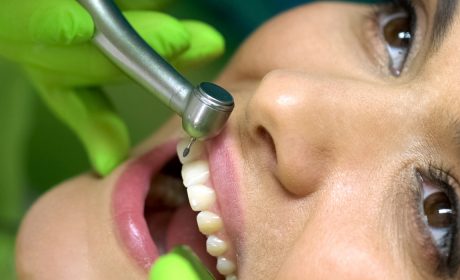 Three Broken Tooth Repair Options You’ll Be Glad To Know About
