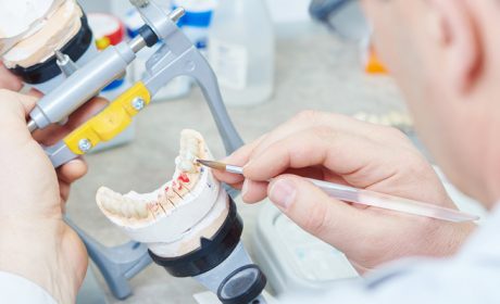 Get Dental Implant Solutions at an Affordable Prosthodontist Office