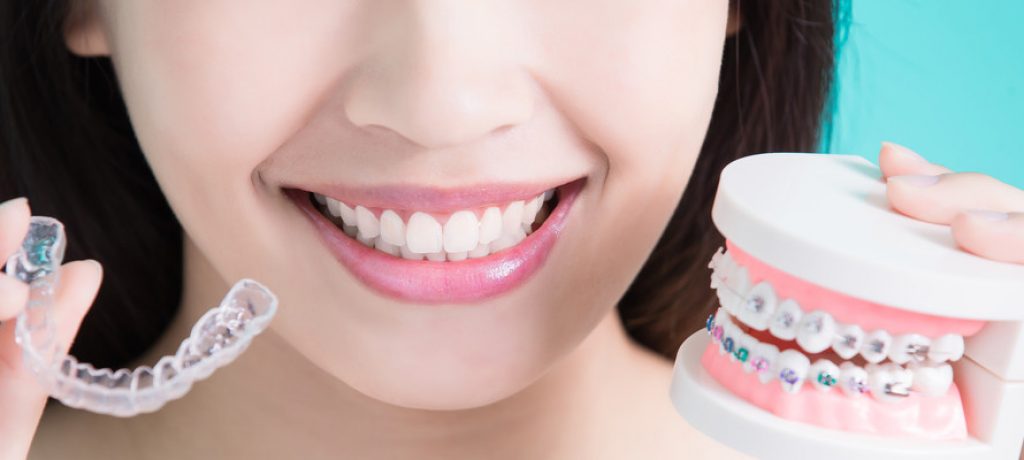 Straightening Teeth: The Options Available Today