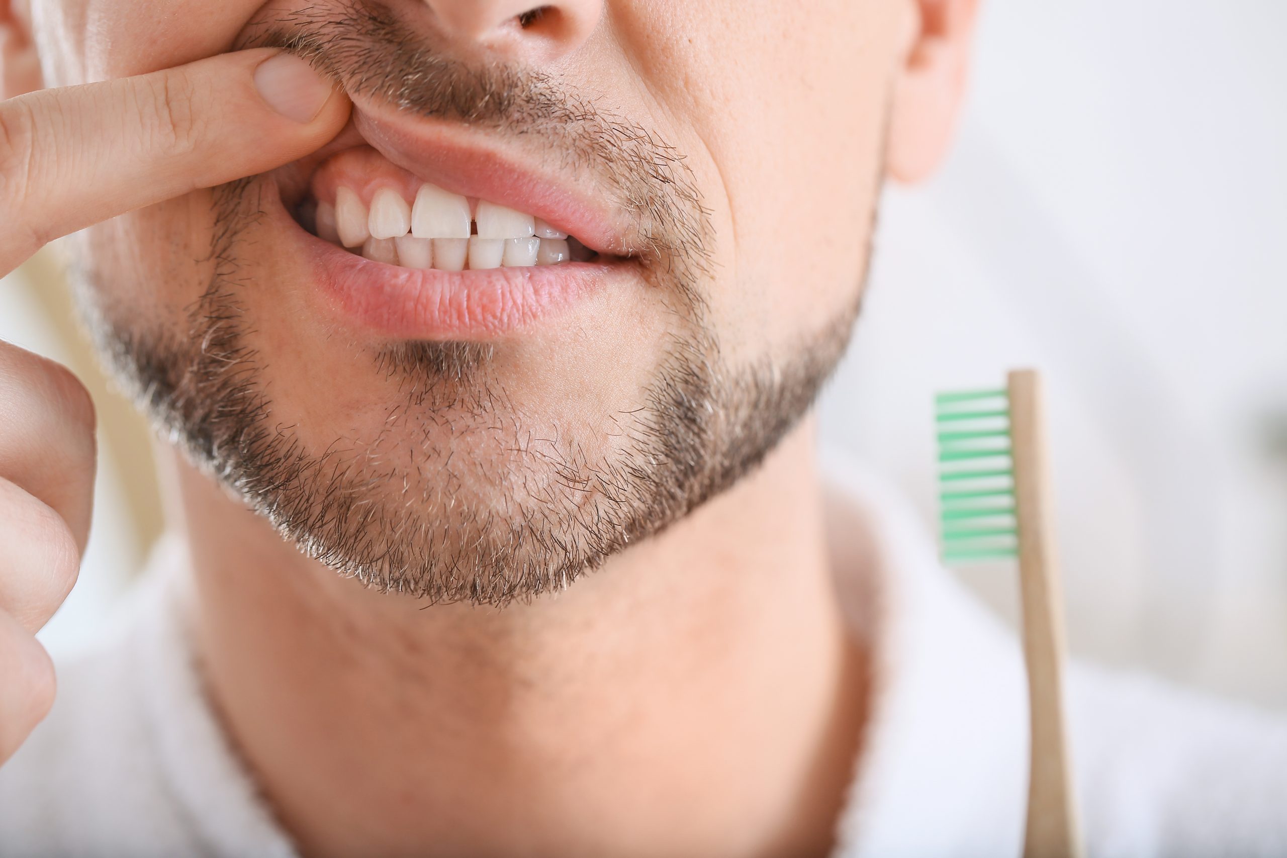 How does alcohol affect the mouth? It can contribute to gum disease, as this man holding a toothbrush while pointing to his inflamed gum knows.