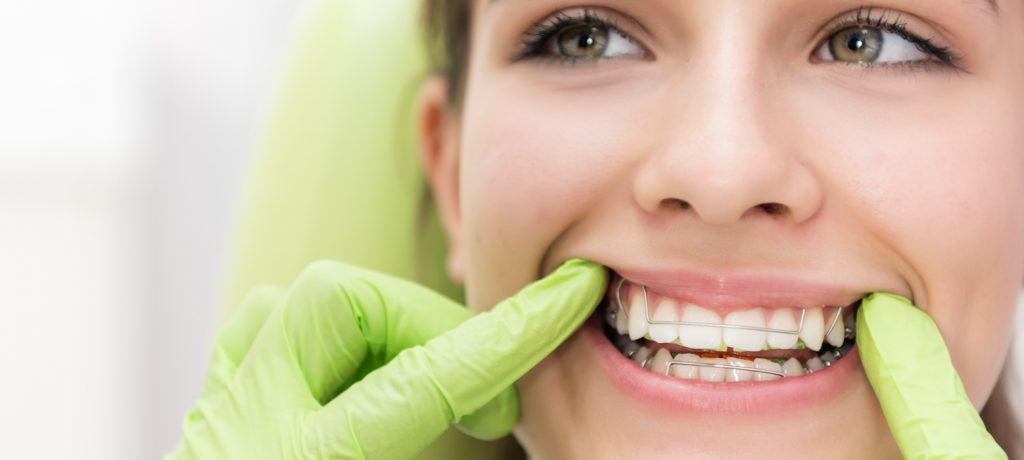 Talking to Your Teen: Three Tips for Getting Braces When It’s Time