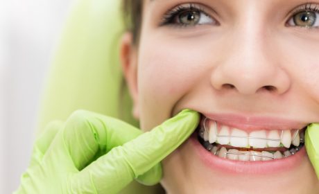 Talking to Your Teen: Three Tips for Getting Braces When It’s Time