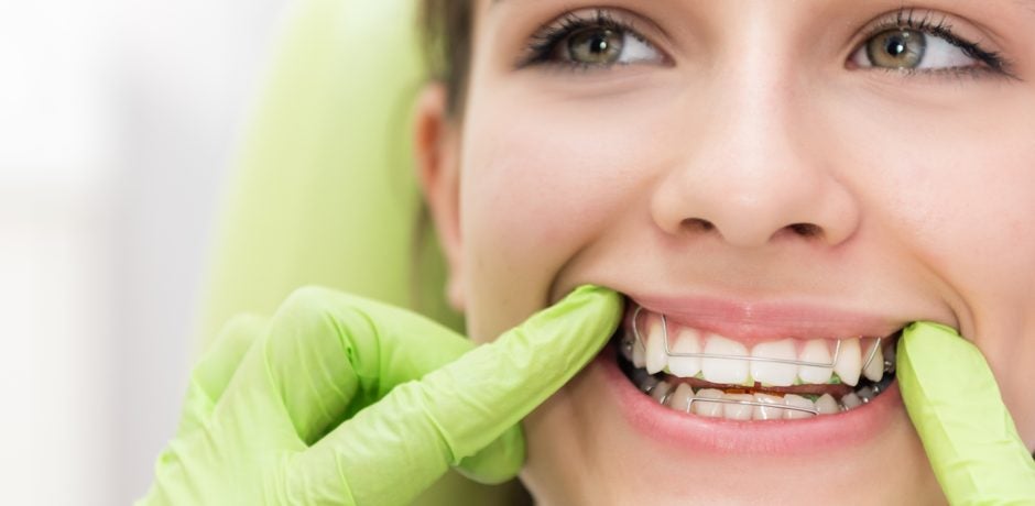 Talking to Your Teen: Three Tips for Getting Braces When It’s Time