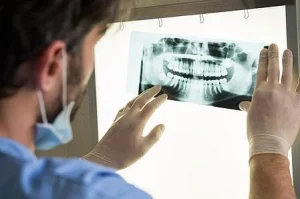 Closeup of dentist looking at dental a x-ray plate.