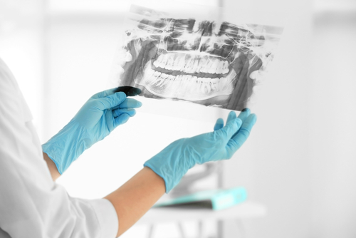 Female dentist holding a dental X-Ray.