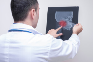 Male doctor in white coat looking at x-ray at jaw point in the room.