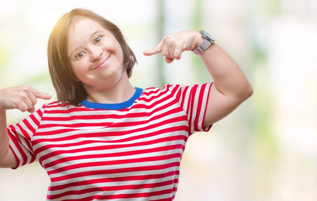 Woman with facial characteristics of Down syndrome playfully tilts her head and points to her smile after dental treatments. 