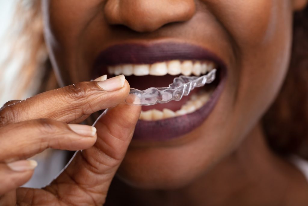 An adult woman places invisible aligner braces on her top teeth, part of adult braces treatment in Philadelphia.