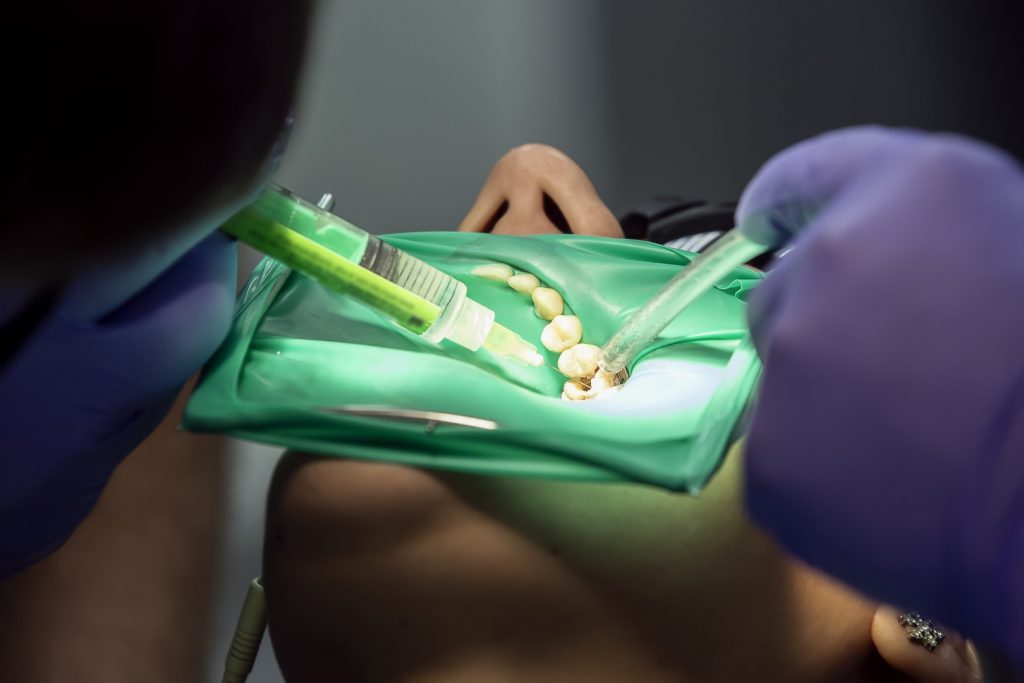 A dentist performs a root canal in Philadelphia on a patient’s mouth.