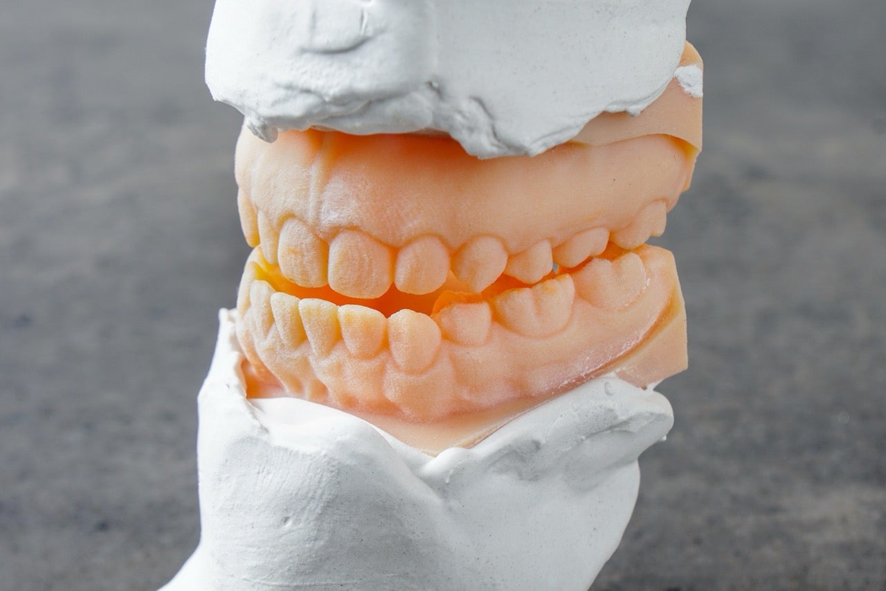 A plastic model of an underbite surrounded by plaster. 