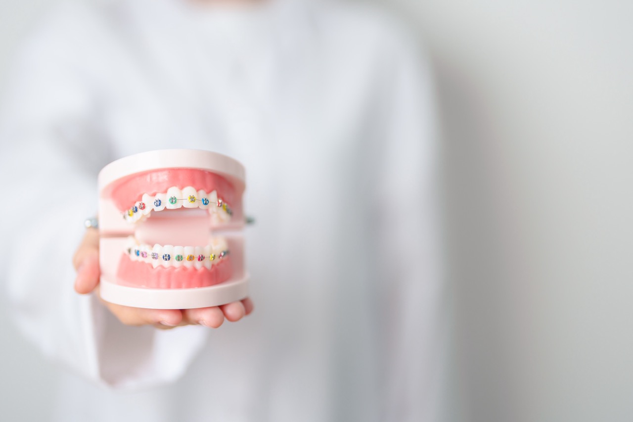 An orthodontist holds a model of a mouth with multicolored braces on the teeth. 