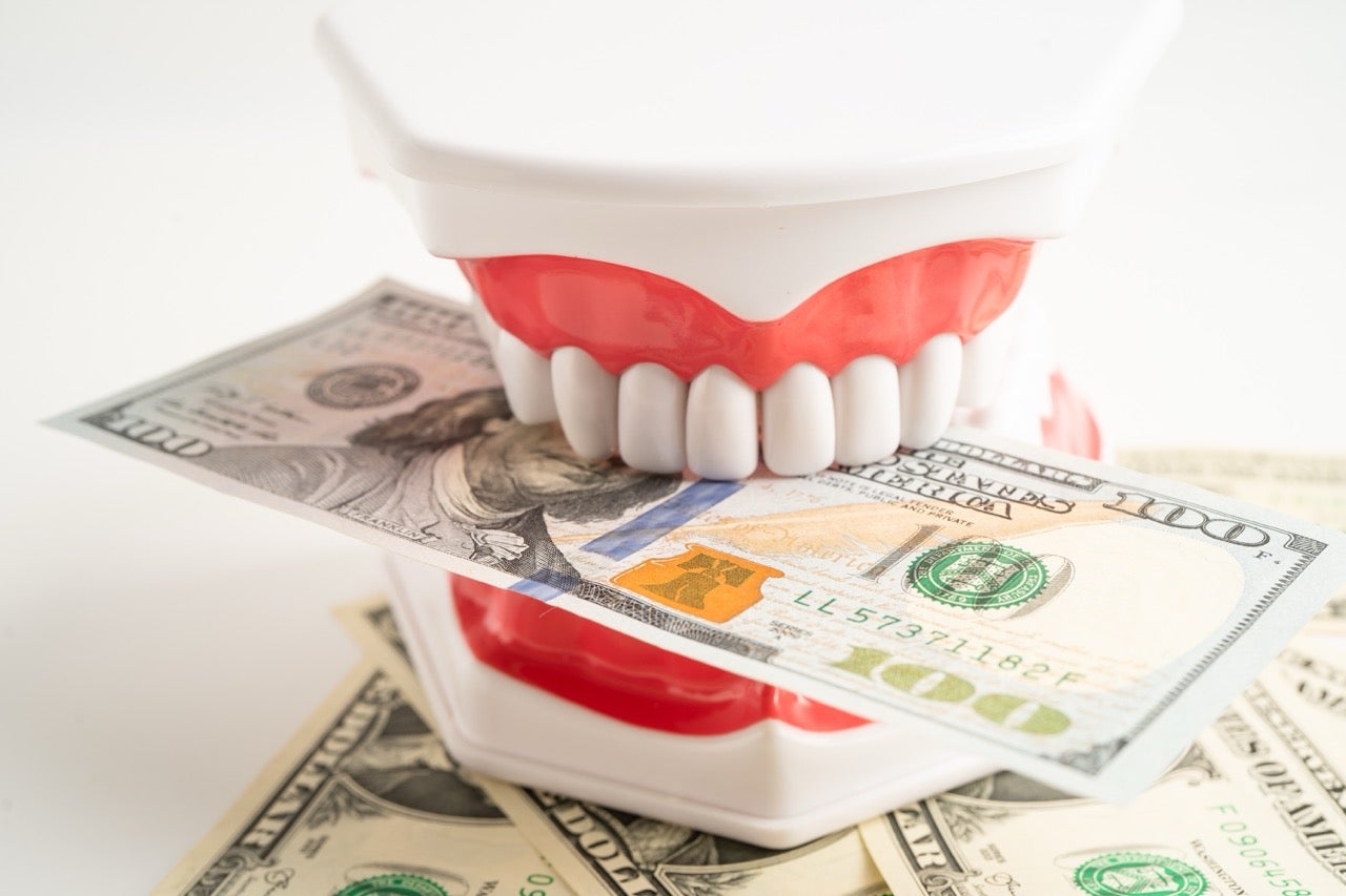 A tooth model with a $100 bill between the teeth. 
