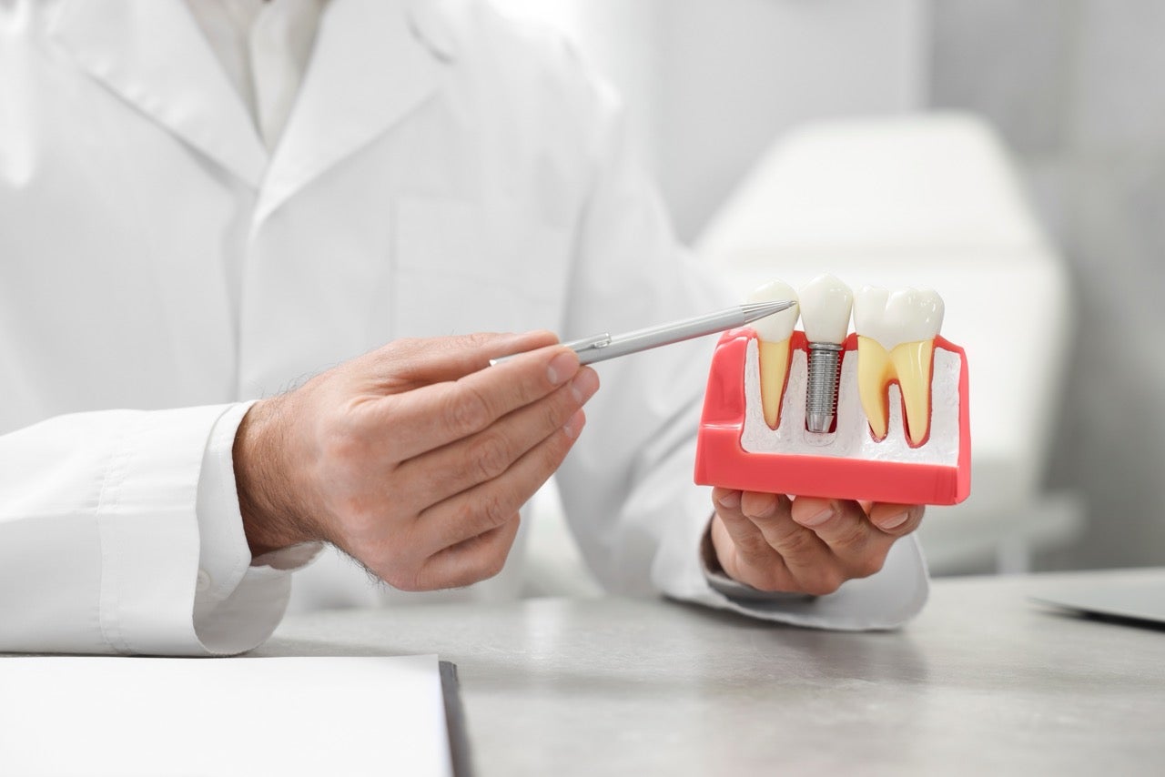 A dentist points a pen at a model showing normal teeth and a dental implant.