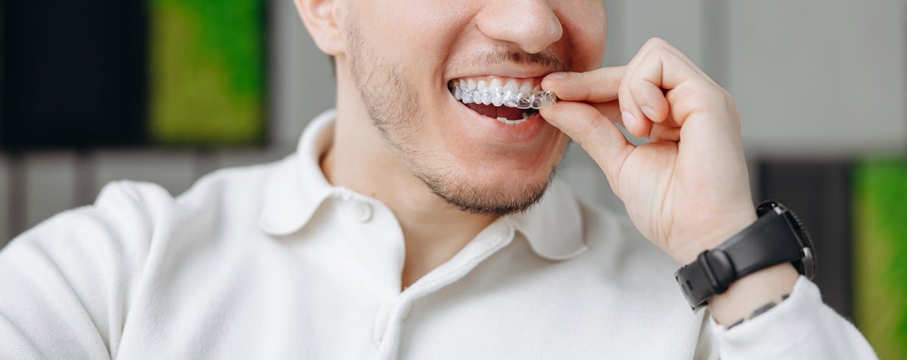 A man puts an Invisalign tray on his top teeth. 