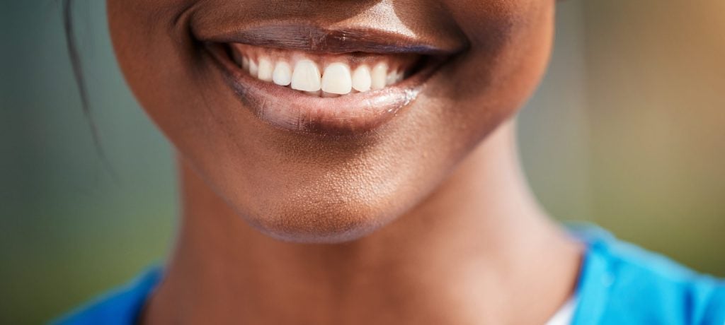 Orthodontics: More Than Getting Straight Teeth